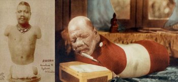 Человека-гусеница – история принца Рандиана из цирка Барнума